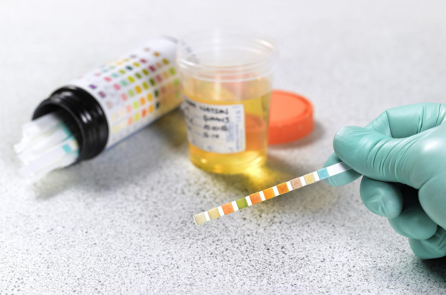 Understanding Alcohol Test Results and Their Implications